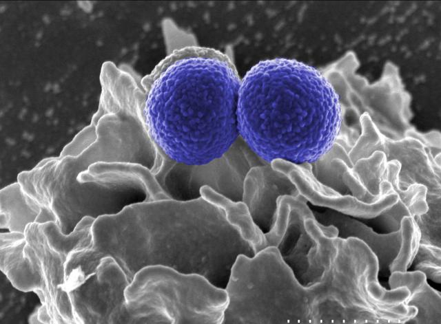 Methicillin Resistant staphylococcus MRSA.jpg